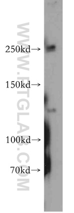 PTCH2 Antibody in Western Blot (WB)