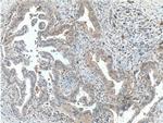 Frizzled 8 Antibody in Immunohistochemistry (Paraffin) (IHC (P))