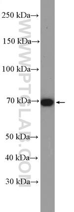 Frizzled 8 Antibody in Western Blot (WB)