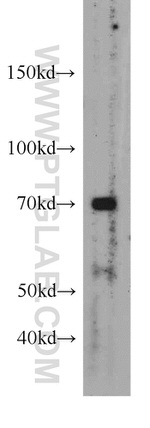 Frizzled 8 Antibody in Western Blot (WB)
