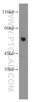 PKMYT1 Antibody in Western Blot (WB)