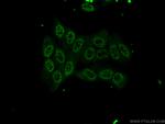 SPI1 Antibody in Immunocytochemistry (ICC/IF)