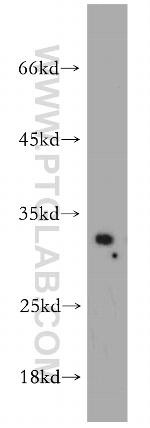 SPI1 Antibody in Western Blot (WB)