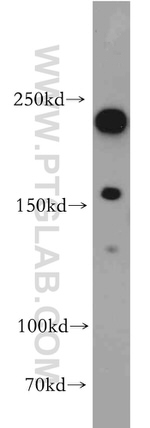 AF-6 Antibody in Western Blot (WB)