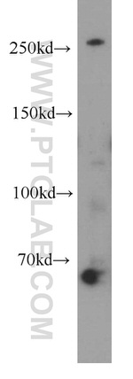 SPTBN2 Antibody in Western Blot (WB)