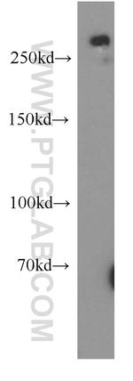 SPTBN2 Antibody in Western Blot (WB)