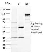 DOG-1/TMEM16A Antibody in SDS-PAGE (SDS-PAGE)