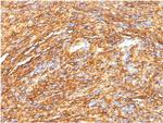 DOG-1/TMEM16A Antibody in Immunohistochemistry (Paraffin) (IHC (P))