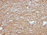 DOG-1/TMEM16A Antibody in Immunohistochemistry (Paraffin) (IHC (P))