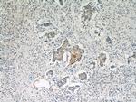 MAGEA4 Antibody in Immunohistochemistry (Paraffin) (IHC (P))