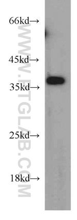 MAGEA4 Antibody in Western Blot (WB)