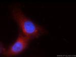 TRPM1 Antibody in Immunocytochemistry (ICC/IF)