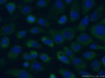 TRPM1 Antibody in Immunocytochemistry (ICC/IF)