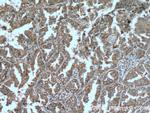 TRPM1 Antibody in Immunohistochemistry (Paraffin) (IHC (P))