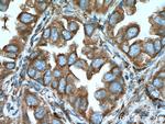 TRPM1 Antibody in Immunohistochemistry (Paraffin) (IHC (P))