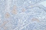 TRPM1 Antibody in Immunohistochemistry (Paraffin) (IHC (P))