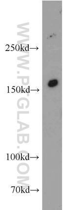 INSRR Antibody in Western Blot (WB)