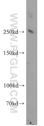 INSRR Antibody in Western Blot (WB)