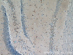 NOTCH3 Antibody in Immunohistochemistry (Paraffin) (IHC (P))