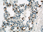 NOTCH3 Antibody in Immunohistochemistry (Paraffin) (IHC (P))