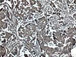 NOTCH3 Antibody in Immunohistochemistry (Paraffin) (IHC (P))