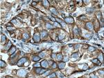 NOTCH3 Antibody in Immunohistochemistry (Paraffin) (IHC (P))