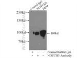 NOTCH3 Antibody in Immunoprecipitation (IP)