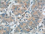 NPR1 Antibody in Immunohistochemistry (Paraffin) (IHC (P))