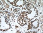 PUMA Antibody in Immunohistochemistry (Paraffin) (IHC (P))