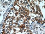 PUMA Antibody in Immunohistochemistry (Paraffin) (IHC (P))