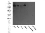 PTPRJ Antibody in Western Blot (WB)