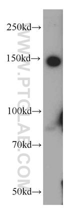 PTPRJ Antibody in Western Blot (WB)