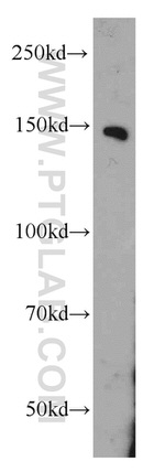 PTPRJ Antibody in Western Blot (WB)