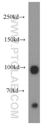 GUCY2D Antibody in Western Blot (WB)