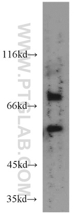 PSAPL1 Antibody in Western Blot (WB)
