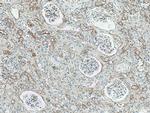 Collagen Type IV Antibody in Immunohistochemistry (Paraffin) (IHC (P))