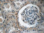 Collagen Type IV Antibody in Immunohistochemistry (Paraffin) (IHC (P))