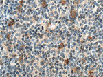 CD30 Antibody in Immunohistochemistry (Paraffin) (IHC (P))