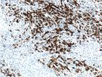 CD30 Antibody in Immunohistochemistry (Paraffin) (IHC (P))