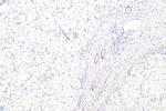 Alpha SMA Antibody in Immunohistochemistry (Paraffin) (IHC (P))