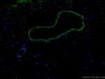 Alpha SMA Antibody in Immunohistochemistry (PFA fixed) (IHC (PFA))