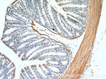 Alpha SMA Antibody in Immunohistochemistry (Paraffin) (IHC (P))