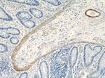 Alpha SMA Antibody in Immunohistochemistry (Paraffin) (IHC (P))