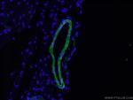 Alpha SMA Antibody in Immunohistochemistry (PFA fixed) (IHC (PFA))