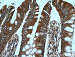 PRKG2 Antibody in Immunohistochemistry (Paraffin) (IHC (P))