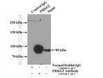 PRKG2 Antibody in Immunoprecipitation (IP)