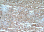 ARHGAP10 Antibody in Immunohistochemistry (Paraffin) (IHC (P))