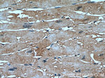 ARHGAP10 Antibody in Immunohistochemistry (Paraffin) (IHC (P))