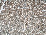 ARHGAP10 Antibody in Immunohistochemistry (Paraffin) (IHC (P))