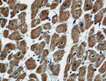 ARHGAP10 Antibody in Immunohistochemistry (Paraffin) (IHC (P))